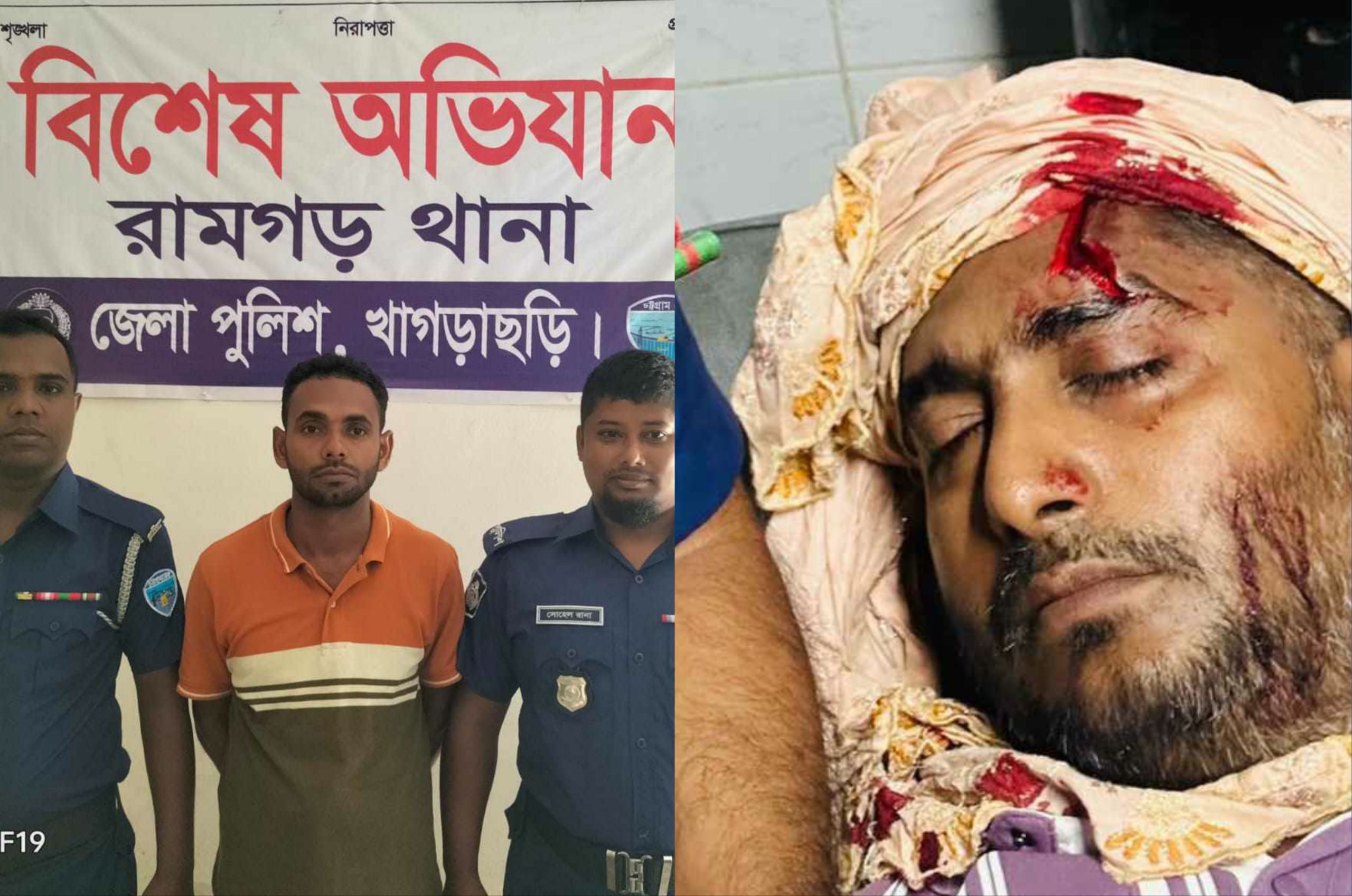 রামগড়ে ওয়ারেন্টভুক্ত আসামির হামলায় পুলিশ সদস্য গুরুতর আহত 